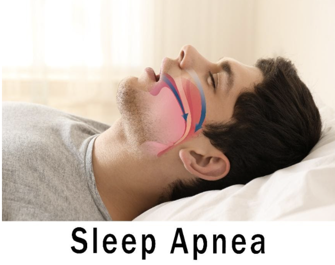 Area Terapeutica